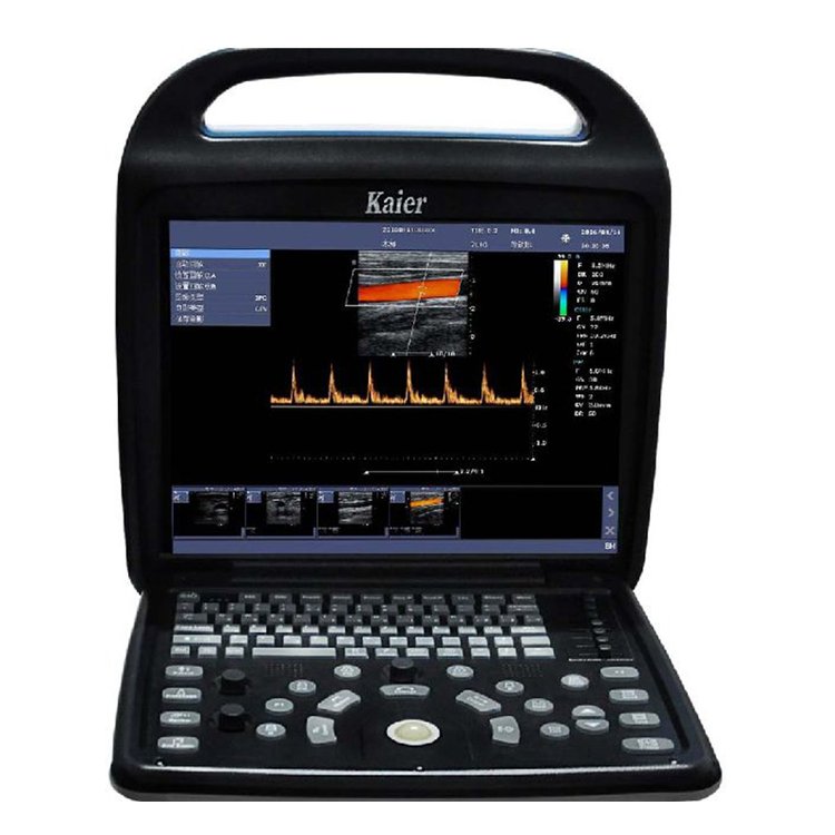 国产彩超设备医用便携式彩超机 彩超仪器多普勒超声诊断仪直发 - 爱企