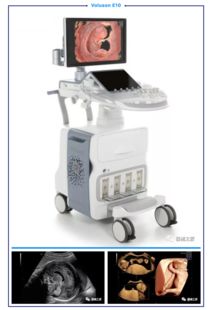 医疗器械新品报道风向标 超声设备创新引领未来诊断